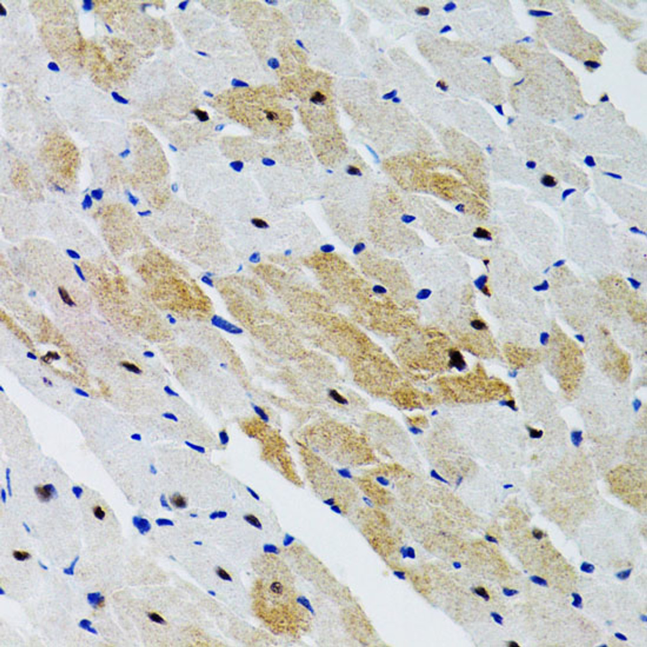 Immunohistochemistry of paraffin-embedded Rat heart using PTPN11 Polyclonal Antibody at dilution of  1:100 (40x lens).