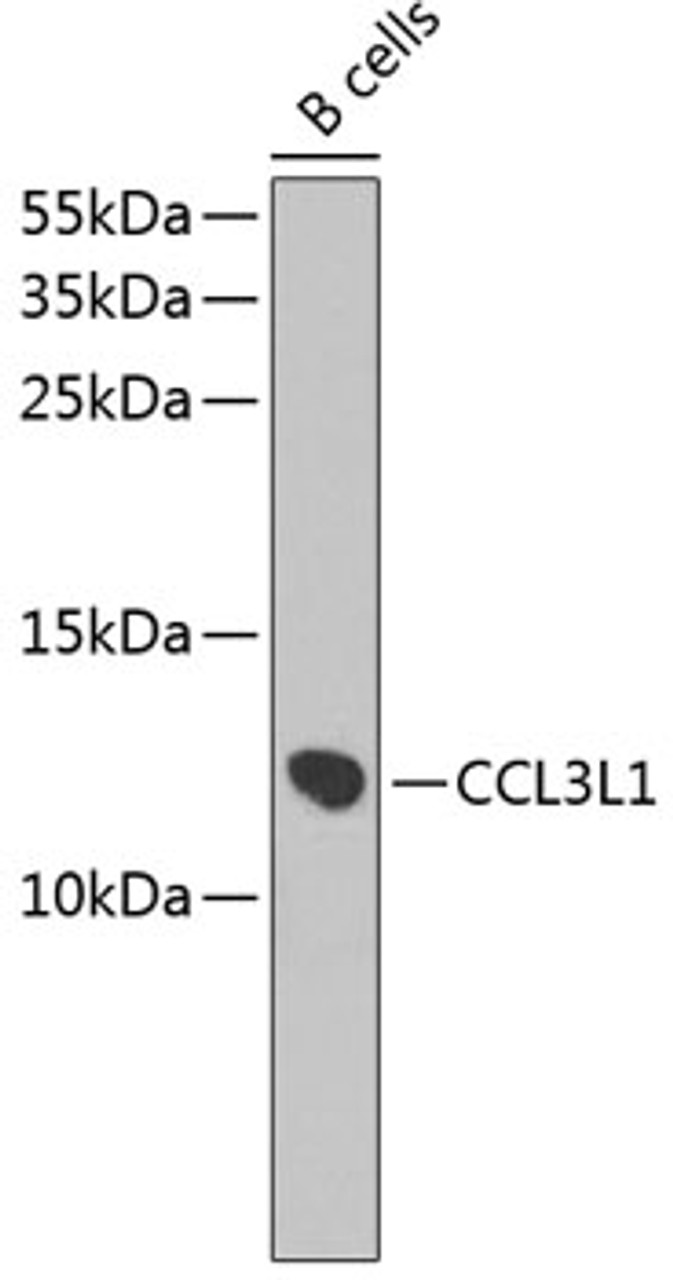 Western blot analysis of extracts of B-cell cells using CCL3L1 Polyclonal Antibody at dilution of 1:1000.