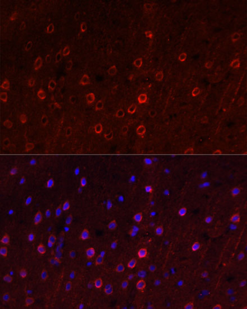 Immunofluorescence analysis of Rat brain using SLC1A1 Polyclonal Antibody at dilution of  1:100. Blue: DAPI for nuclear staining.