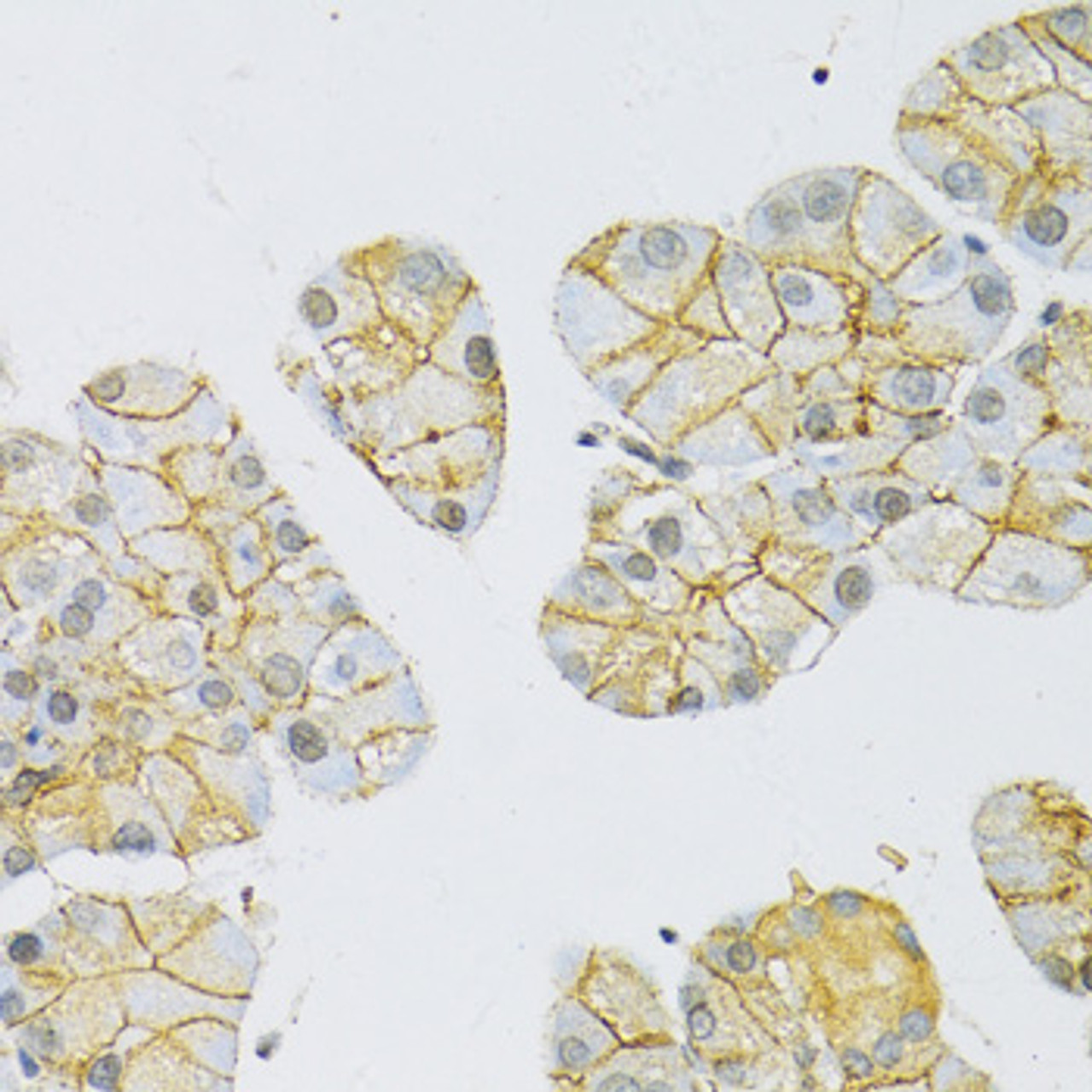 Immunohistochemistry of paraffin-embedded Rat pancreas using MCT1/SLC16A1 Polyclonal Antibody at dilution of  1:100 (40x lens).