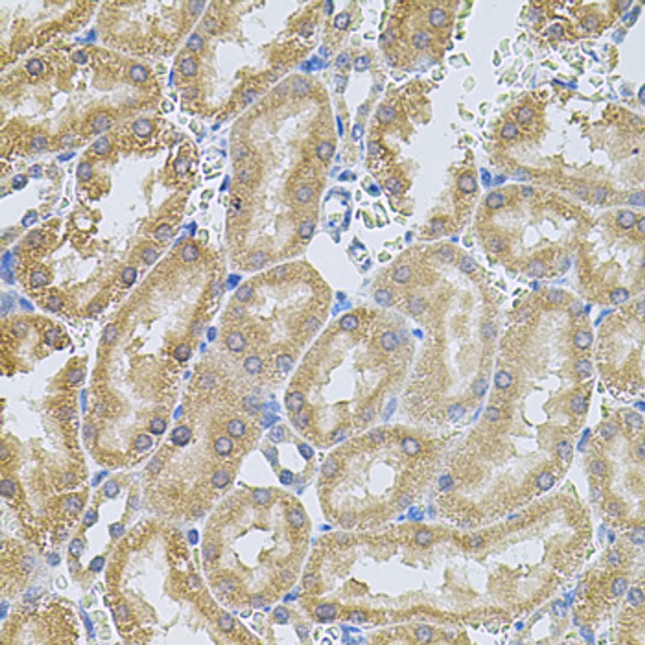Immunohistochemistry of paraffin-embedded Rat kidney using MMP10 Polyclonal Antibody at dilution of  1:100 (40x lens).