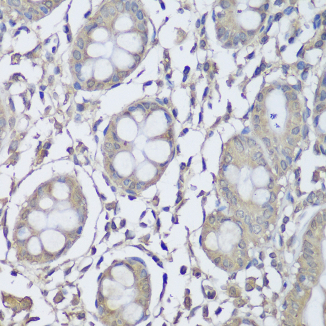 Immunohistochemistry of paraffin-embedded Human colon using CKMT1B Polyclonal Antibody at dilution of  1:150 (40x lens).