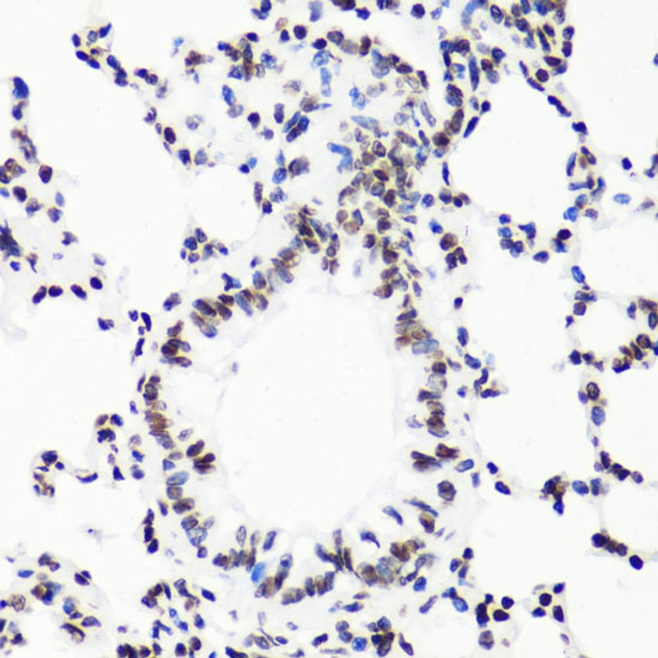 Immunohistochemistry of paraffin-embedded Rat lung using MonoMethyl-Histone H3-R17 Polyclonal Antibody at dilution of  1:100 (40x lens).