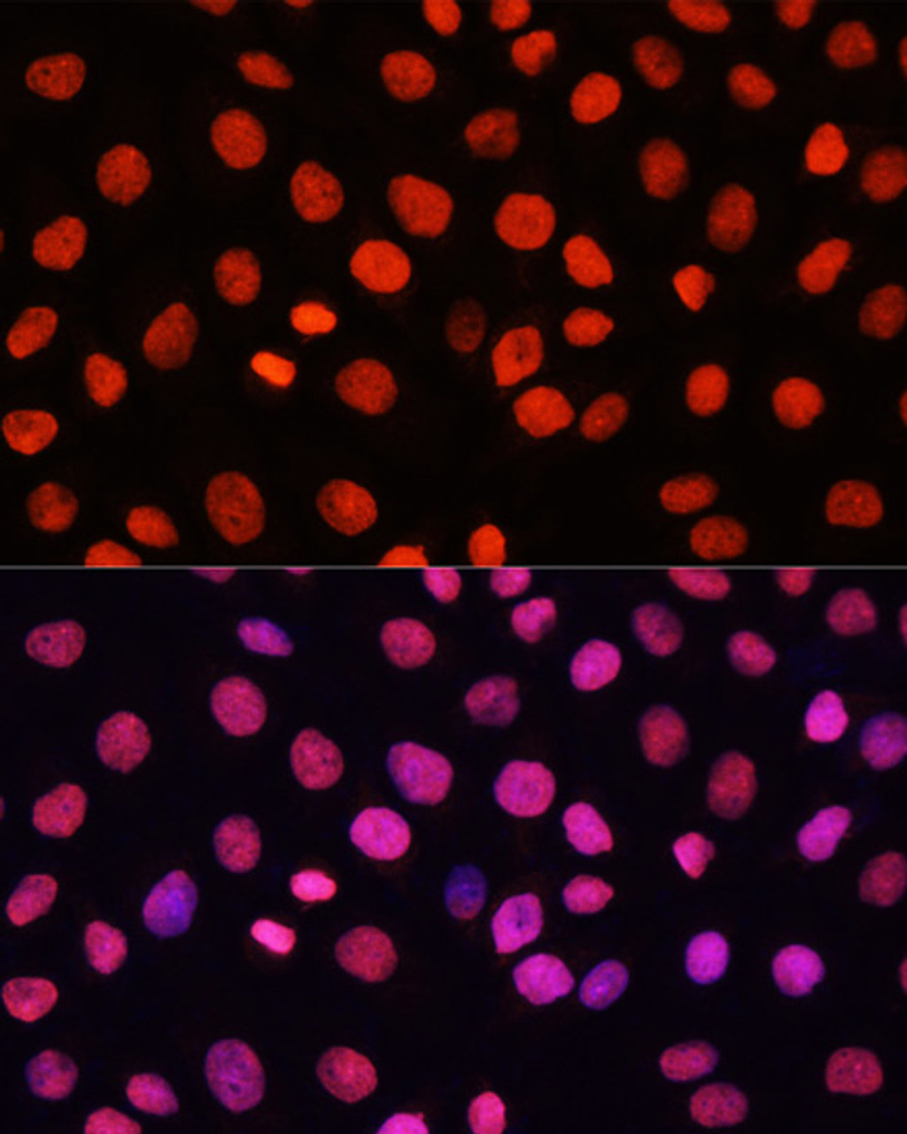 Immunofluorescence analysis of HeLa cells using MonoMethyl-Histone H3-R17 Polyclonal Antibody at dilution of  1:100. Blue: DAPI for nuclear staining.