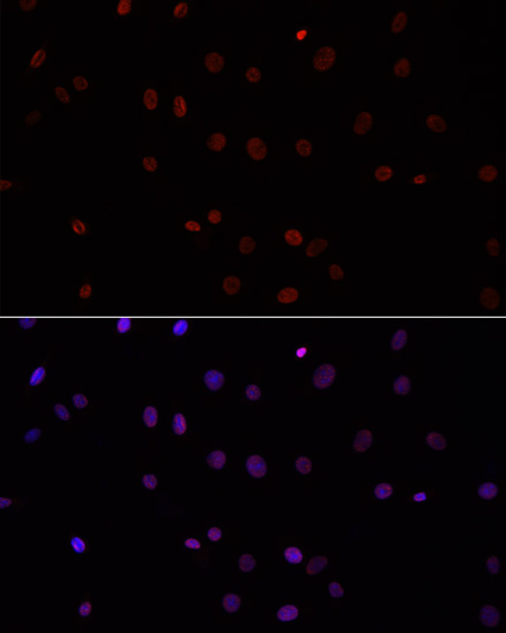 Immunofluorescence analysis of C6 cells using Symmetric DiMethyl-Histone H3-R26 Polyclonal Antibody at dilution of  1:100. Blue: DAPI for nuclear staining.