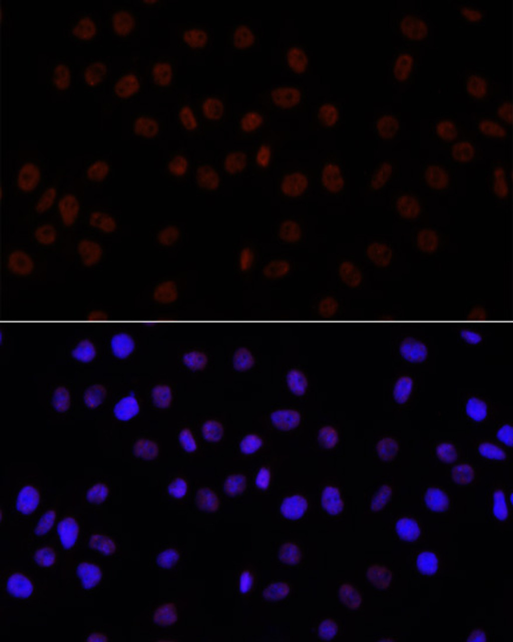 Immunofluorescence analysis of HeLa cells using Symmetric DiMethyl-Histone H3-R26 Polyclonal Antibody at dilution of  1:100. Blue: DAPI for nuclear staining.