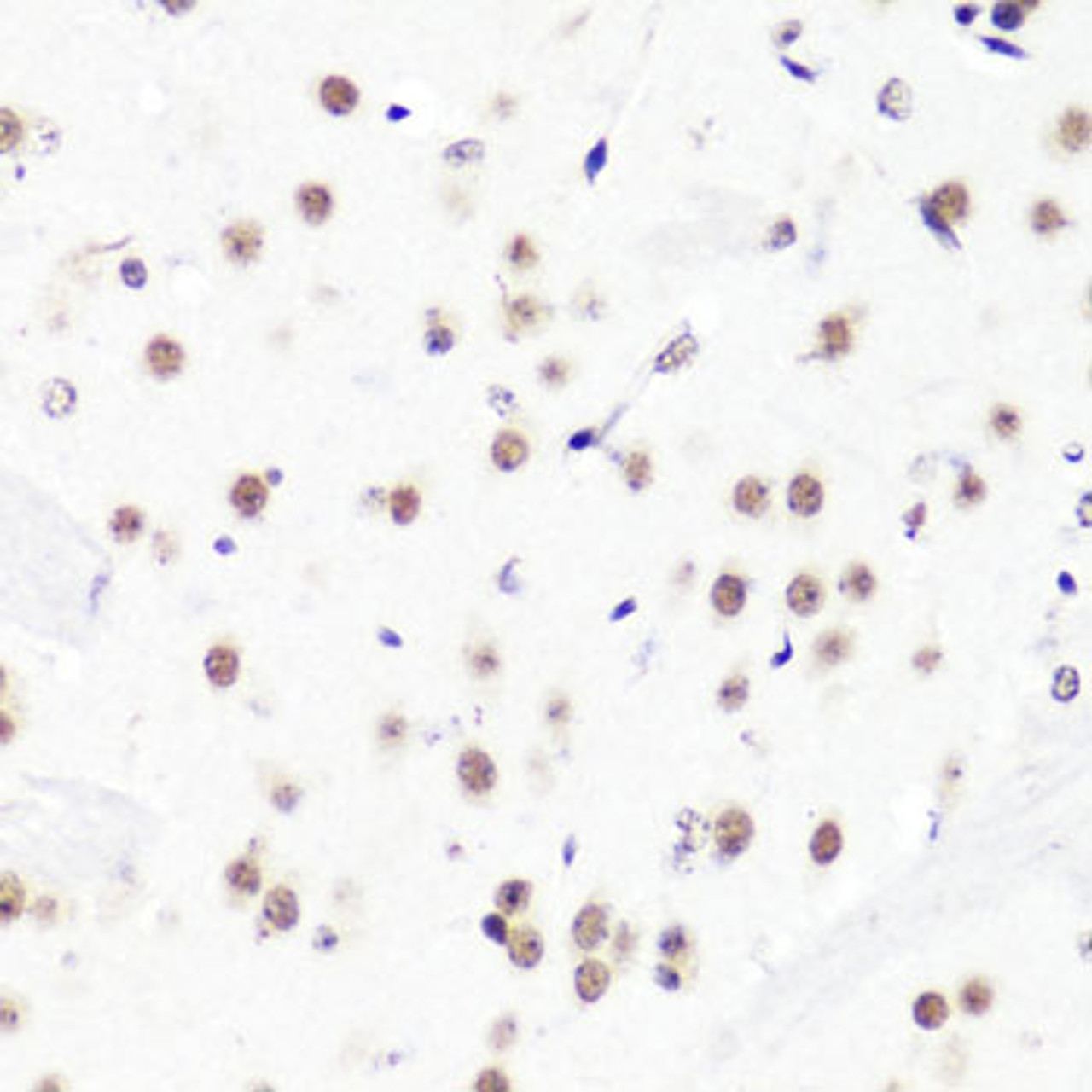 Immunohistochemistry of paraffin-embedded Mouse brain using Asymmetric DiMethyl-Histone H3-R2 Polyclonal Antibody at dilution of  1:100 (40x lens).