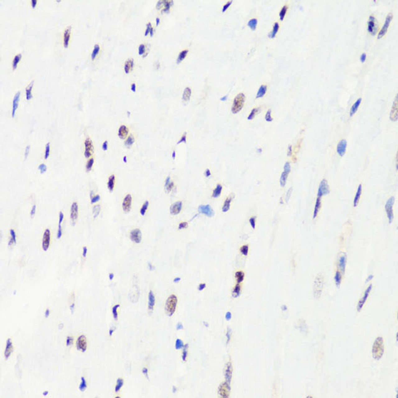 Immunohistochemistry of paraffin-embedded Rat heart using MonoMethyl-Histone H3-R8 Polyclonal Antibody at dilution of  1:100 (40x lens).