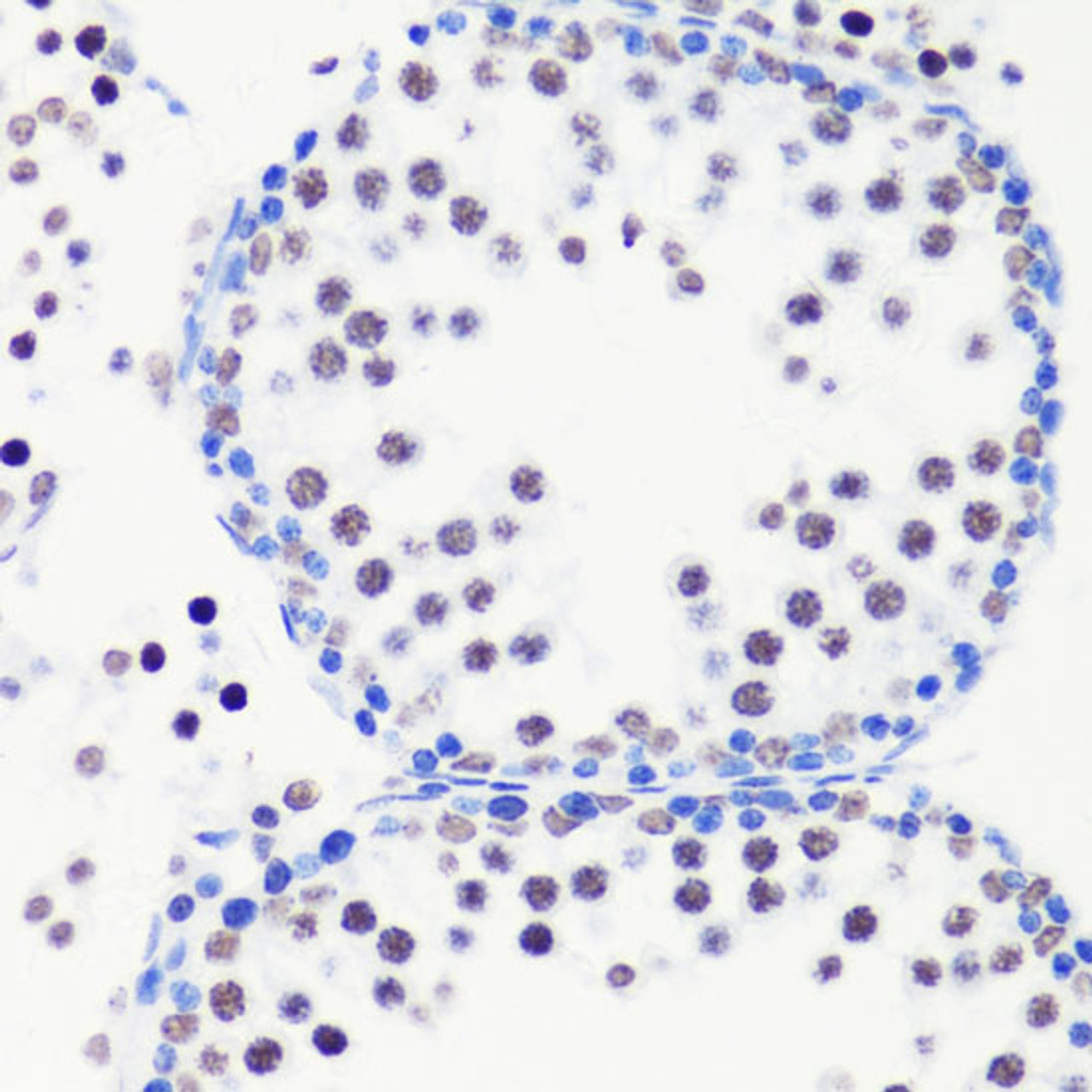 Immunohistochemistry of paraffin-embedded Mouse testis using MonoMethyl-Histone H3-R8 Polyclonal Antibody at dilution of  1:100 (40x lens).