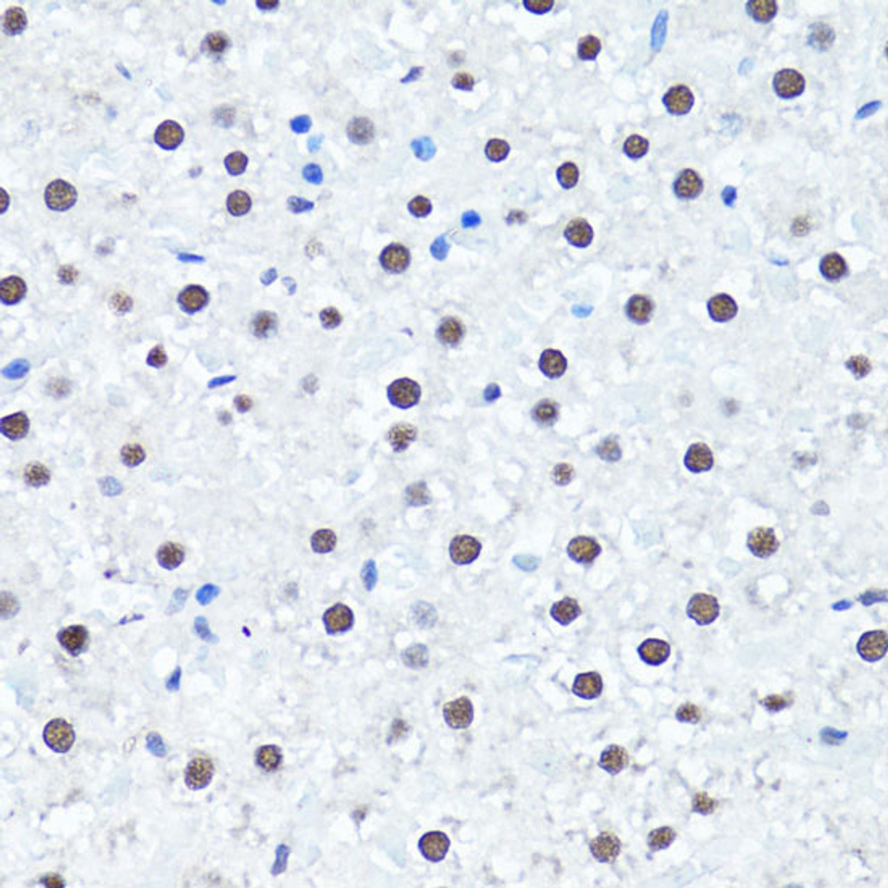 Immunohistochemistry of paraffin-embedded Rat liver using Symmetric DiMethyl-Histone H4-R3 Polyclonal Antibody at dilution of  1:100 (40x lens).