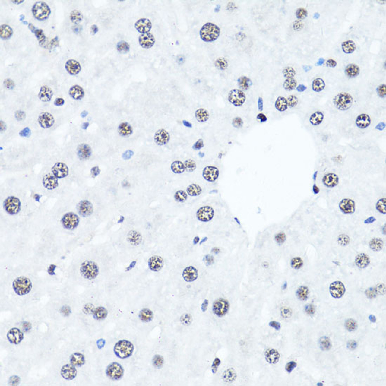 Immunohistochemistry of paraffin-embedded Mouse liver using Symmetric DiMethyl-Histone H4-R3 Polyclonal Antibody at dilution of  1:100 (40x lens).