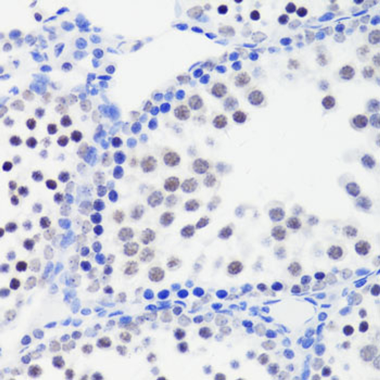 Immunohistochemistry of paraffin-embedded Mouse testis using MonoMethyl-Histone H3-R26 Polyclonal Antibody at dilution of  1:100 (40x lens).