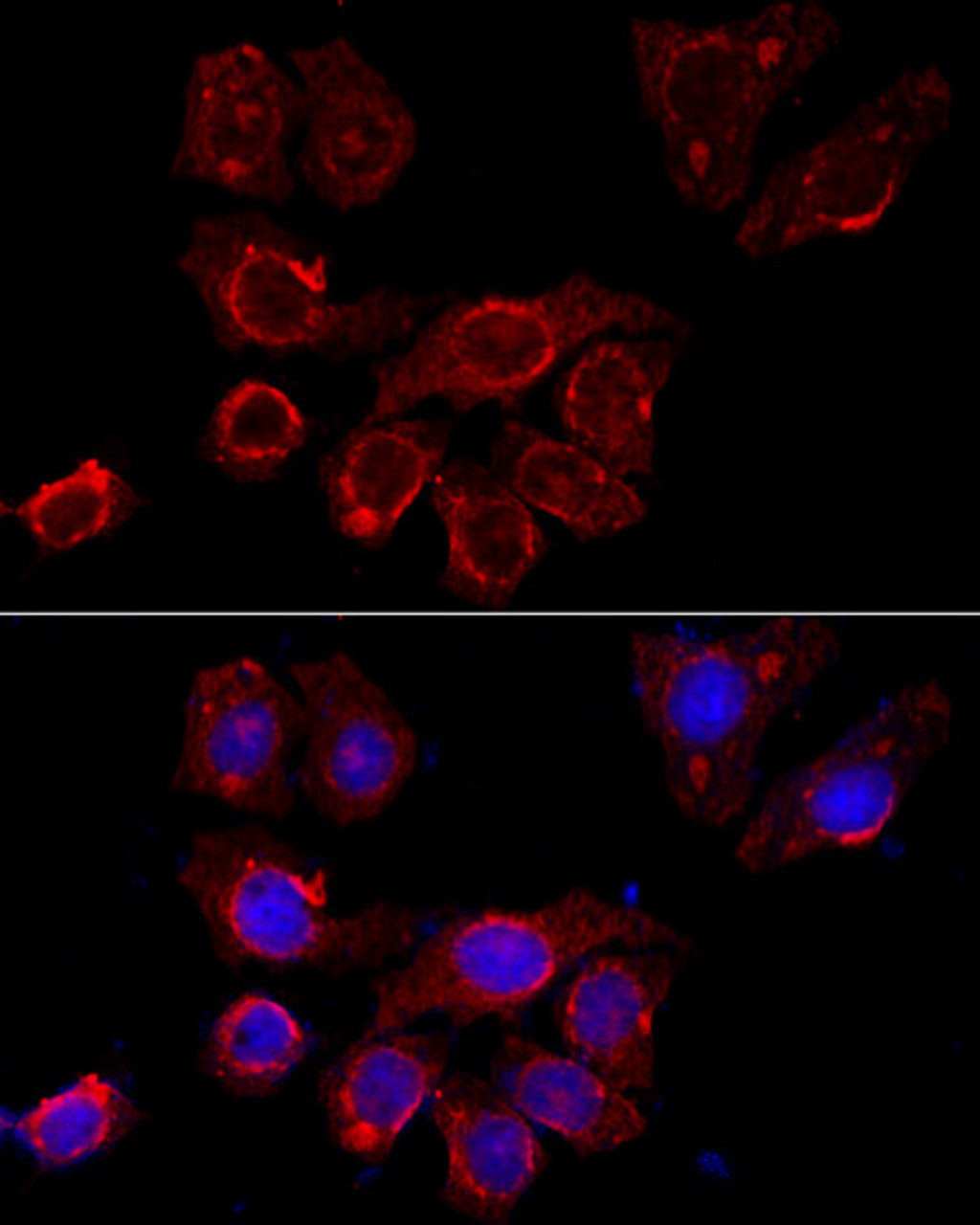 Immunofluorescence analysis of HeLa cells using CSF2RA Polyclonal Antibody at dilution of  1:100 (40x lens). Blue: DAPI for nuclear staining.