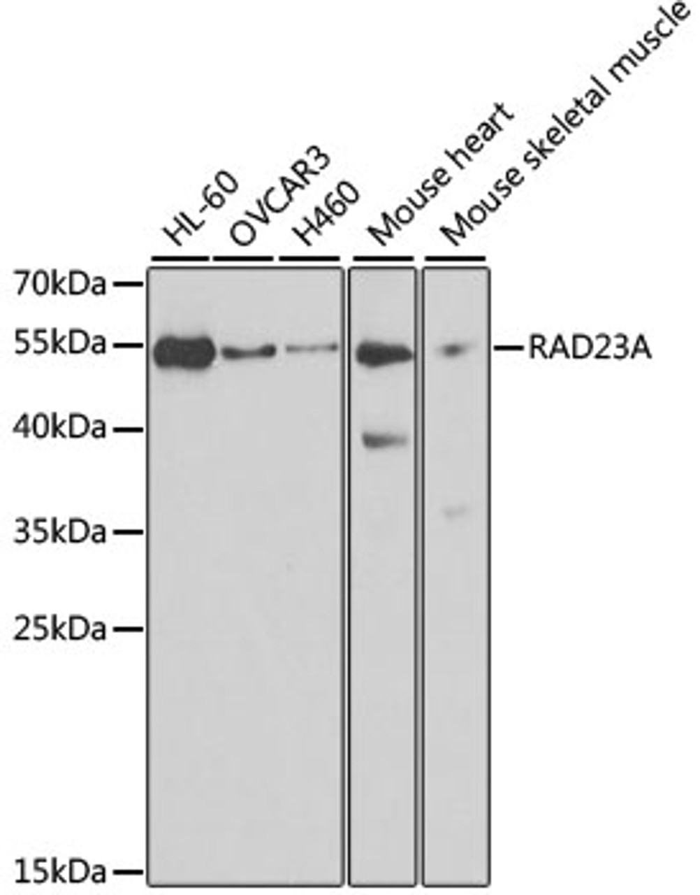 Western blot analysis of extracts of various cell lines using RAD23A Polyclonal Antibody at dilution of 1:1000.