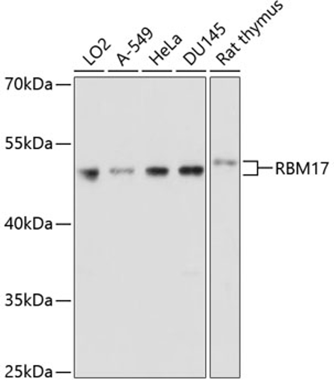 Western blot analysis of extracts of various cell lines using RBM17 Polyclonal Antibody at dilution of 1:1000.