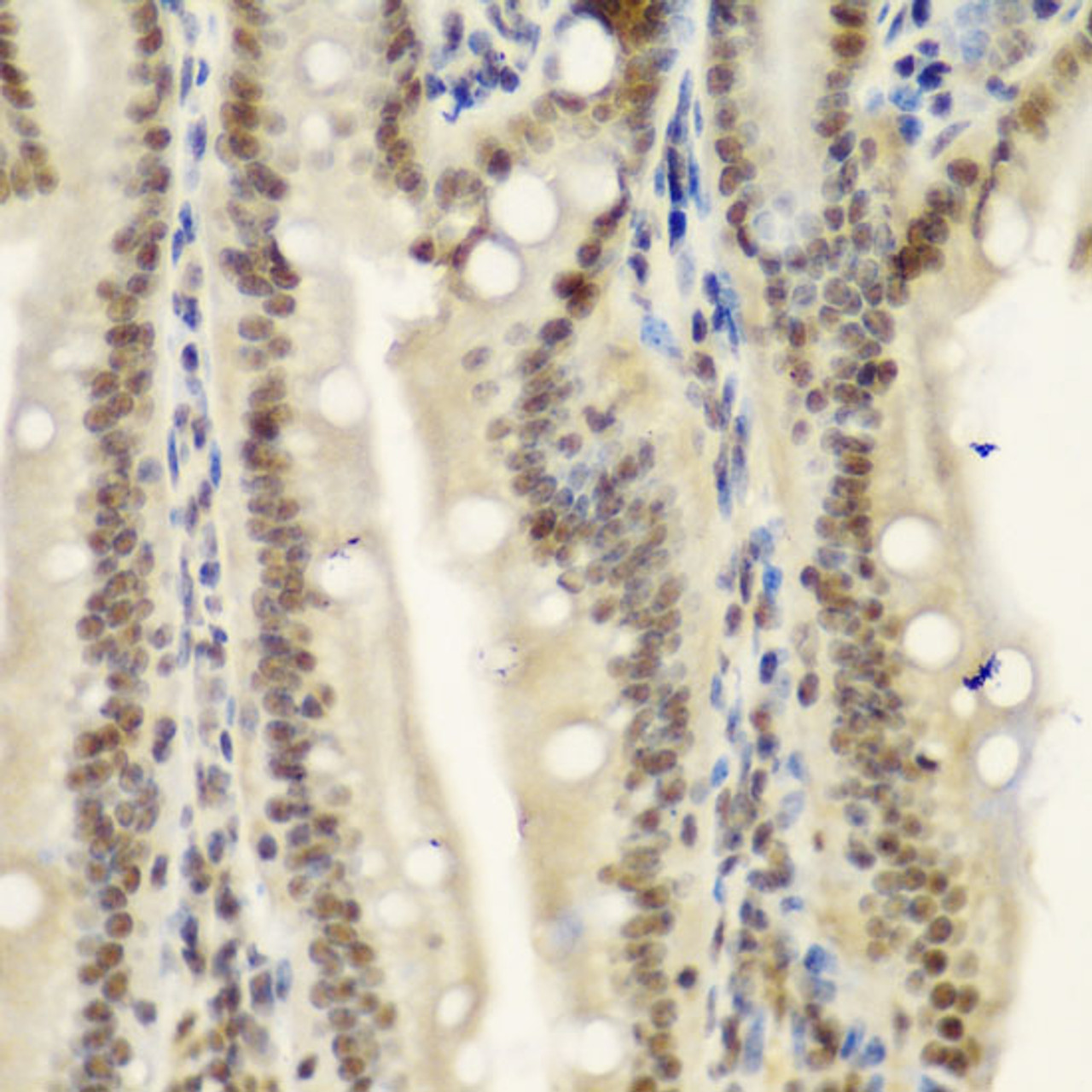 Immunohistochemistry of paraffin-embedded Mouse Intestine using NELFE Polyclonal Antibody at dilution of  1:100 (40x lens).