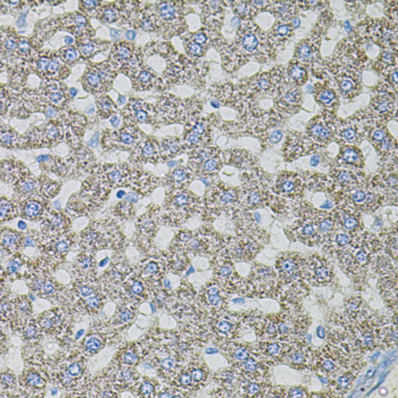 Immunohistochemistry of paraffin-embedded Rat liver using ASK1 Polyclonal Antibody