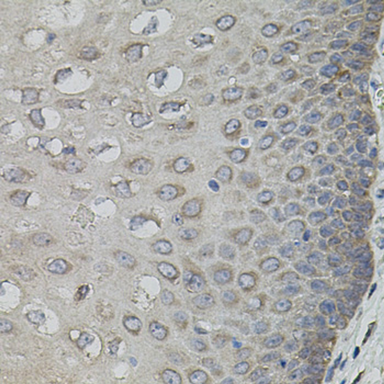 Immunohistochemistry of paraffin-embedded Human esophagus using ASK1 Polyclonal Antibody