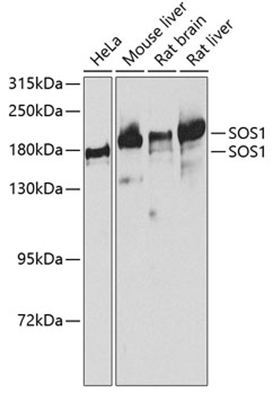 Western blot analysis of extracts of various cell lines using SOS1 Polyclonal Antibody at dilution of 1:1000.