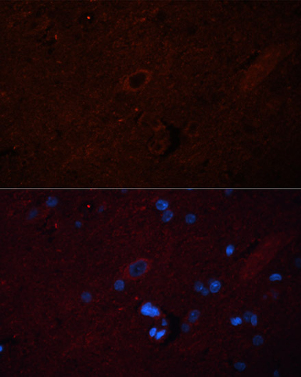 Immunofluorescence analysis of Rat brain using SOS1 Polyclonal Antibody at dilution of  1:100 (40x lens). Blue: DAPI for nuclear staining.