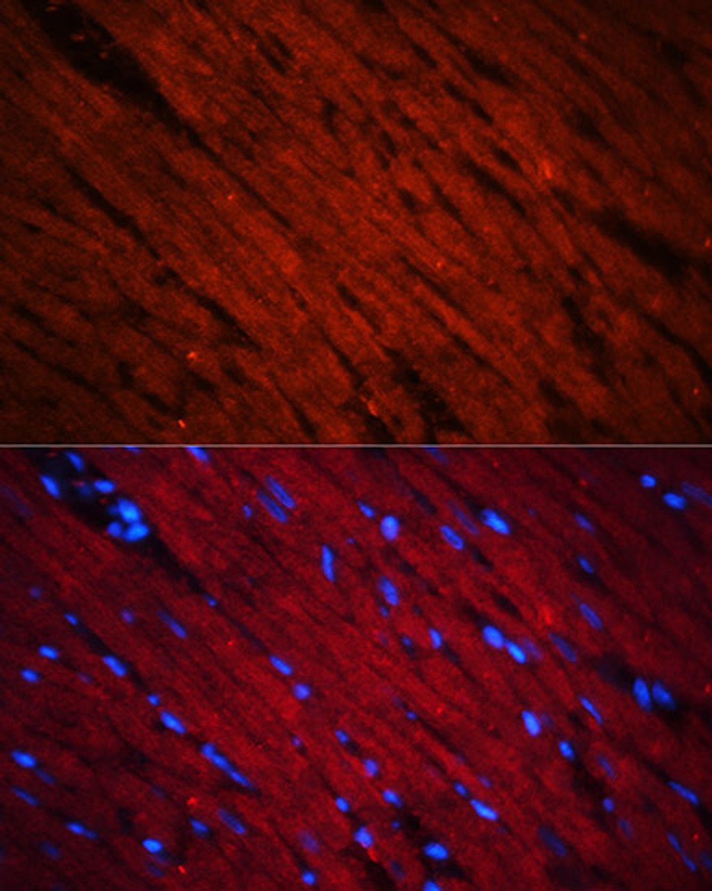 Immunofluorescence analysis of Rat heart using SOS1 Polyclonal Antibody at dilution of  1:100 (40x lens). Blue: DAPI for nuclear staining.