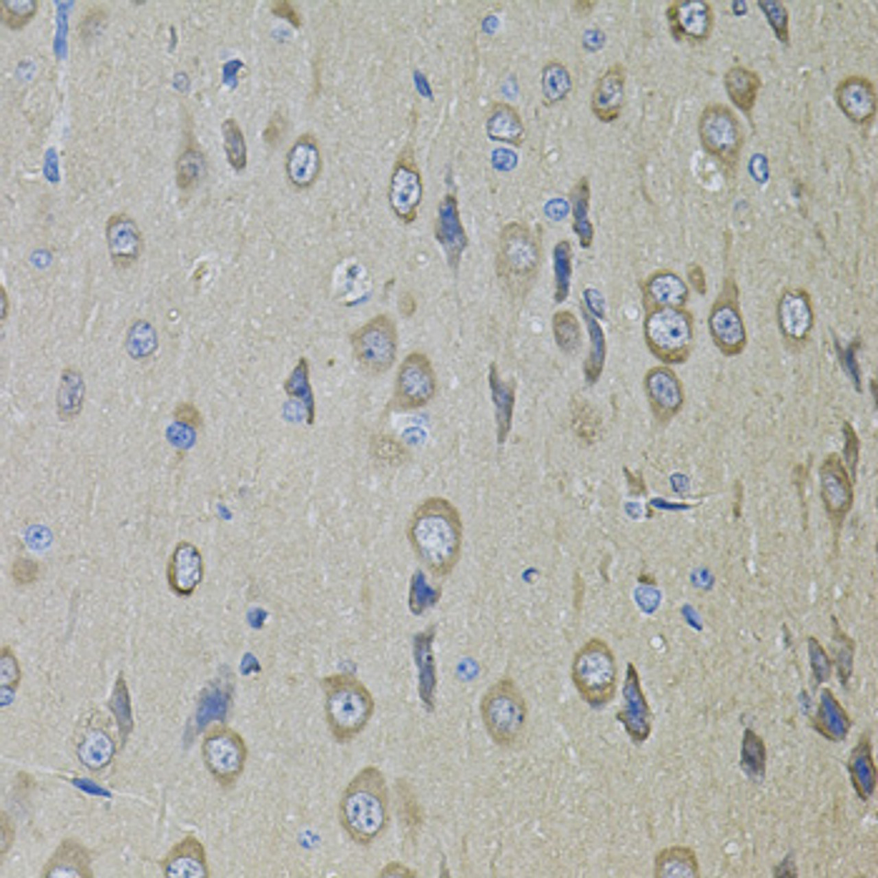 Immunohistochemistry of paraffin-embedded Rat brain using SMO Polyclonal Antibody