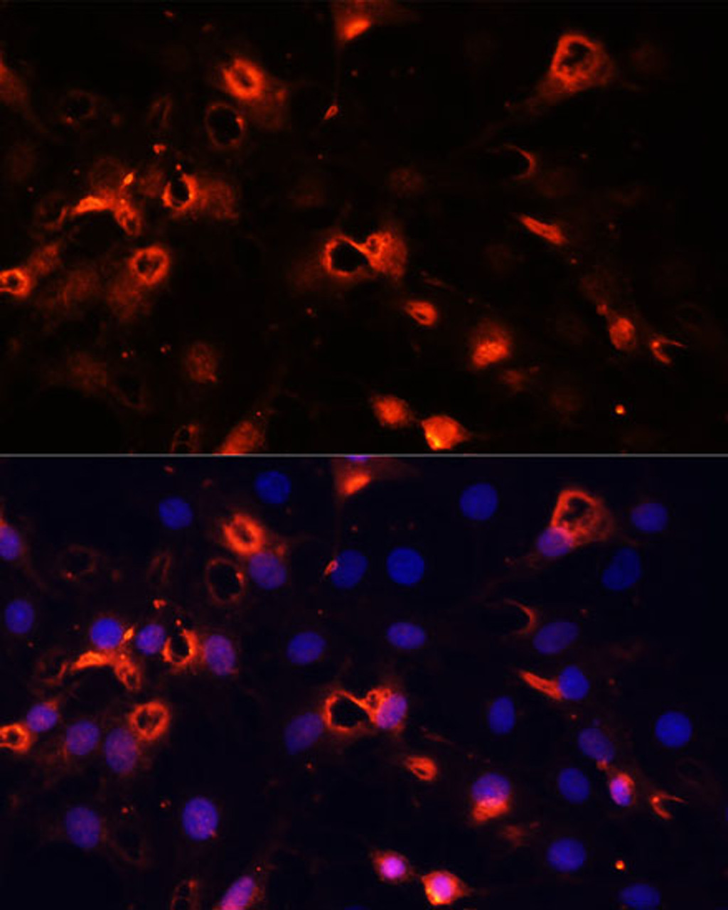 Immunofluorescence analysis of C6 cells using SMO Polyclonal Antibody at dilution of  1:100 (40x lens). Blue: DAPI for nuclear staining.