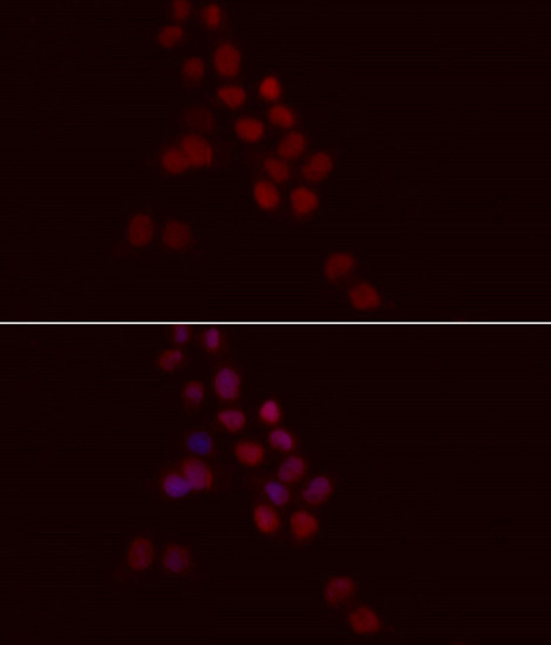 Immunofluorescence analysis of HeLa cells using Histone H1.0 Polyclonal Antibody at dilution of  1:100. Blue: DAPI for nuclear staining.