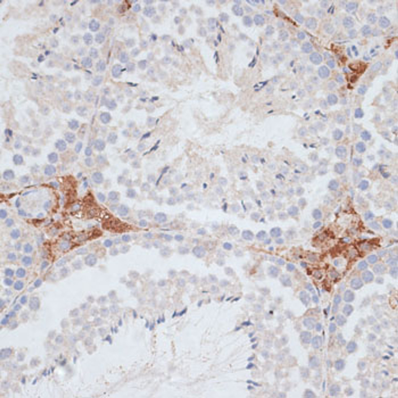 Immunohistochemistry of paraffin-embedded Mouse testis using KIFC1 Polyclonal Antibody at dilution of  1:100 (40x lens).