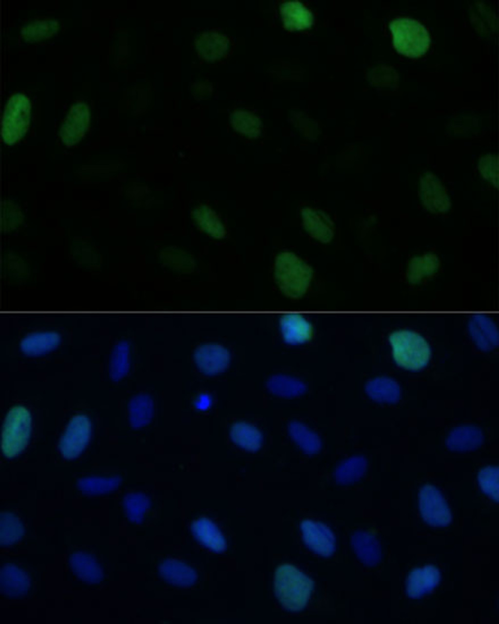 Immunofluorescence analysis of U-2 OS cells using KIFC1 Polyclonal Antibody at dilution of  1:100 (40x lens). Blue: DAPI for nuclear staining.