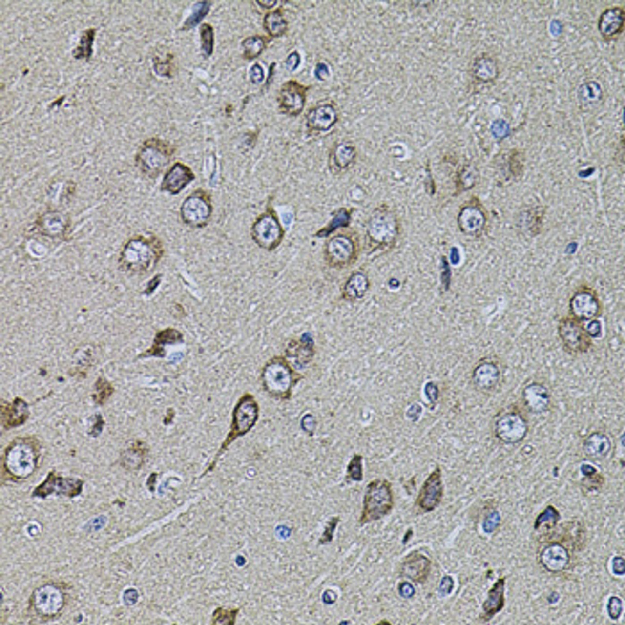 Immunohistochemistry of paraffin-embedded Rat brain using UQCRC1 Polyclonal Antibody at dilution of  1:100 (40x lens).