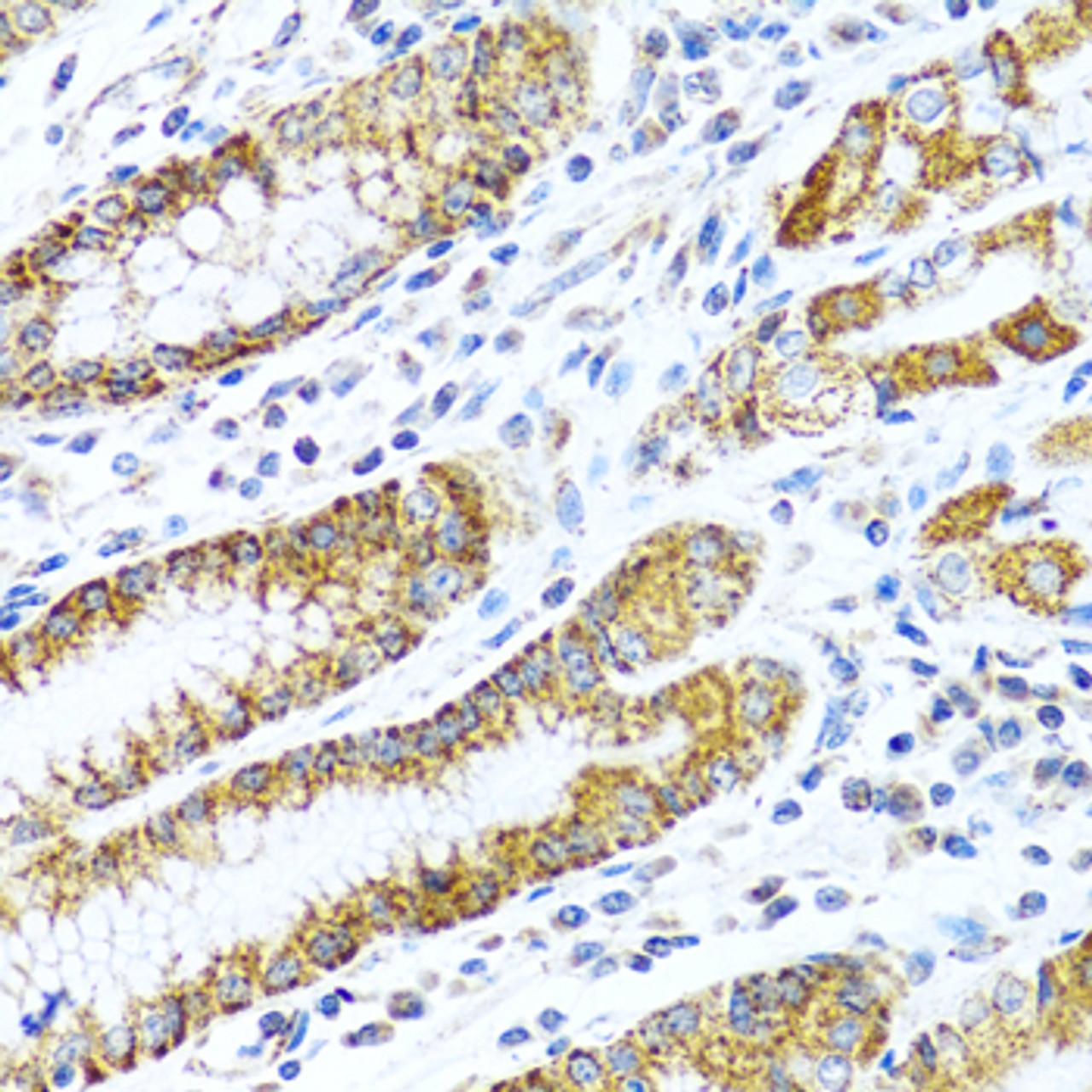 Immunohistochemistry of paraffin-embedded Human stomach using LRPPRC Polyclonal Antibody at dilution of  1:100 (40x lens).