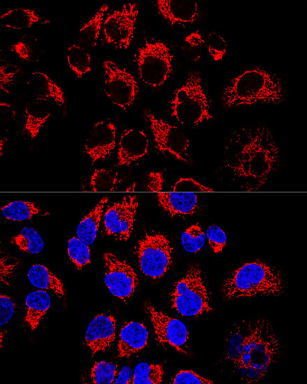 Confocal immunofluorescence analysis of Hela cells using LRPPRC Polyclonal Antibody at dilution of  1:400. Blue: DAPI for nuclear staining.