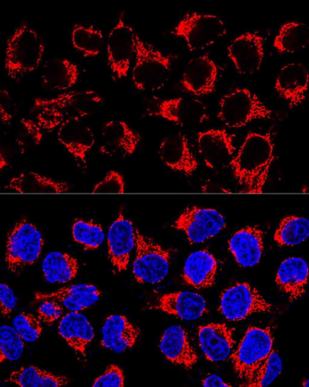 Confocal immunofluorescence analysis of HeLa cells using LRPPRC Polyclonal Antibody at dilution of  1:400. Blue: DAPI for nuclear staining.
