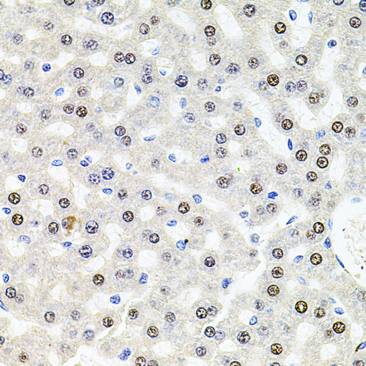 Immunohistochemistry of paraffin-embedded Rat liver using U2SURP Polyclonal Antibody at dilution of  1:100 (40x lens).