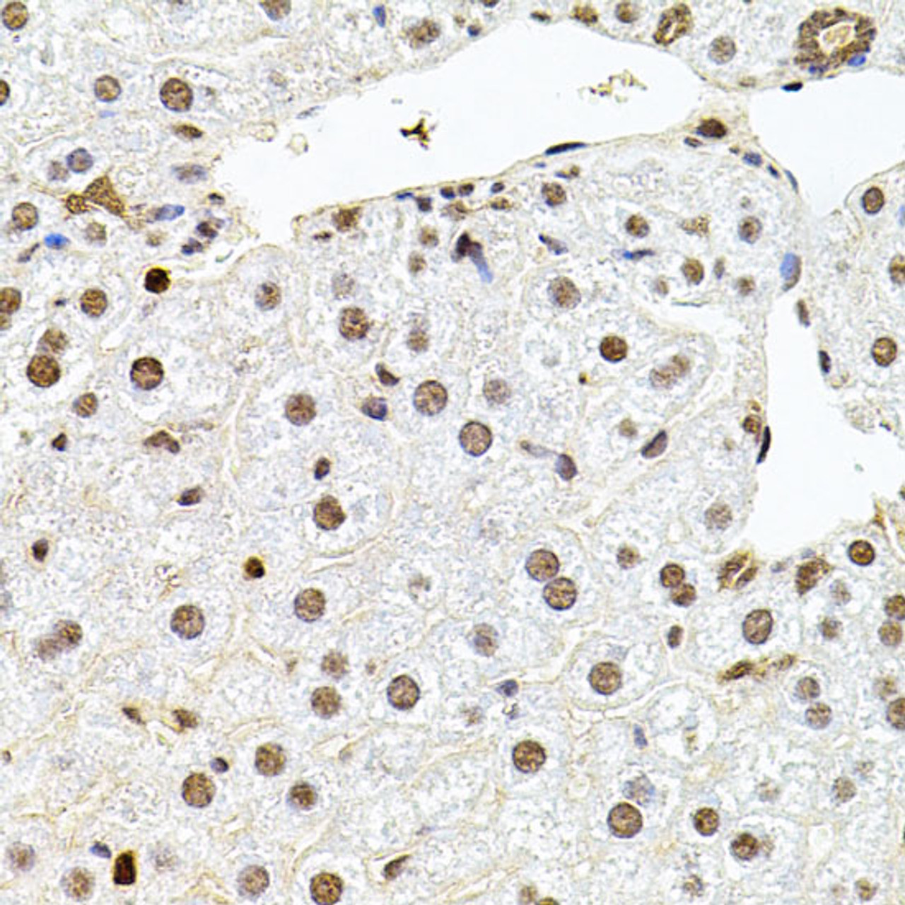 Immunohistochemistry of paraffin-embedded Mouse liver using U2SURP Polyclonal Antibody at dilution of  1:100 (40x lens).