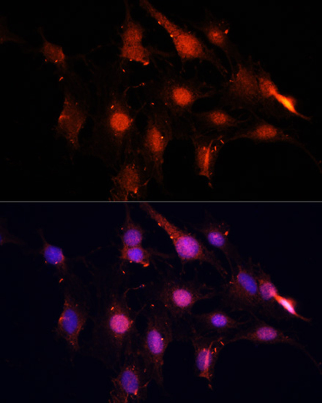 Immunofluorescence analysis of C6 cells using NSUN2 Polyclonal Antibody at dilution of  1:100. Blue: DAPI for nuclear staining.