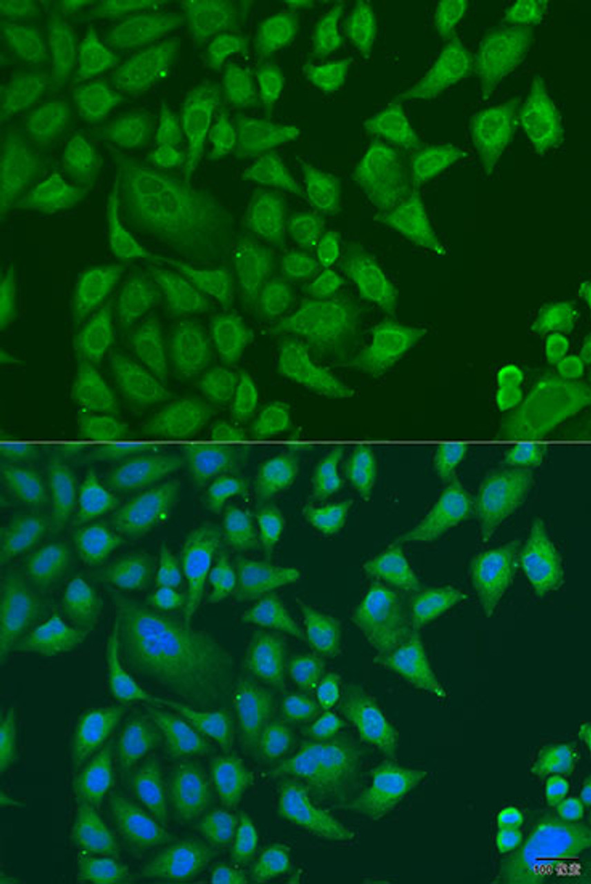 Immunofluorescence analysis of U2OS cells using SUGCT Polyclonal Antibody at dilution of  1:100. Blue: DAPI for nuclear staining.