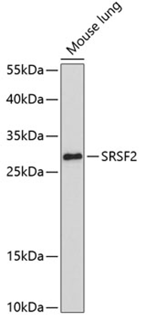 Western blot analysis of extracts of Mouse lung using SRSF2 Polyclonal Antibody at dilution of 1:1000.