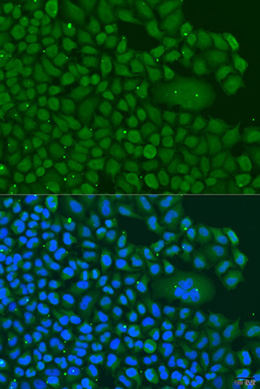 Immunofluorescence analysis of U2OS cells using BBS4 Polyclonal Antibody at dilution of  1:100. Blue: DAPI for nuclear staining.