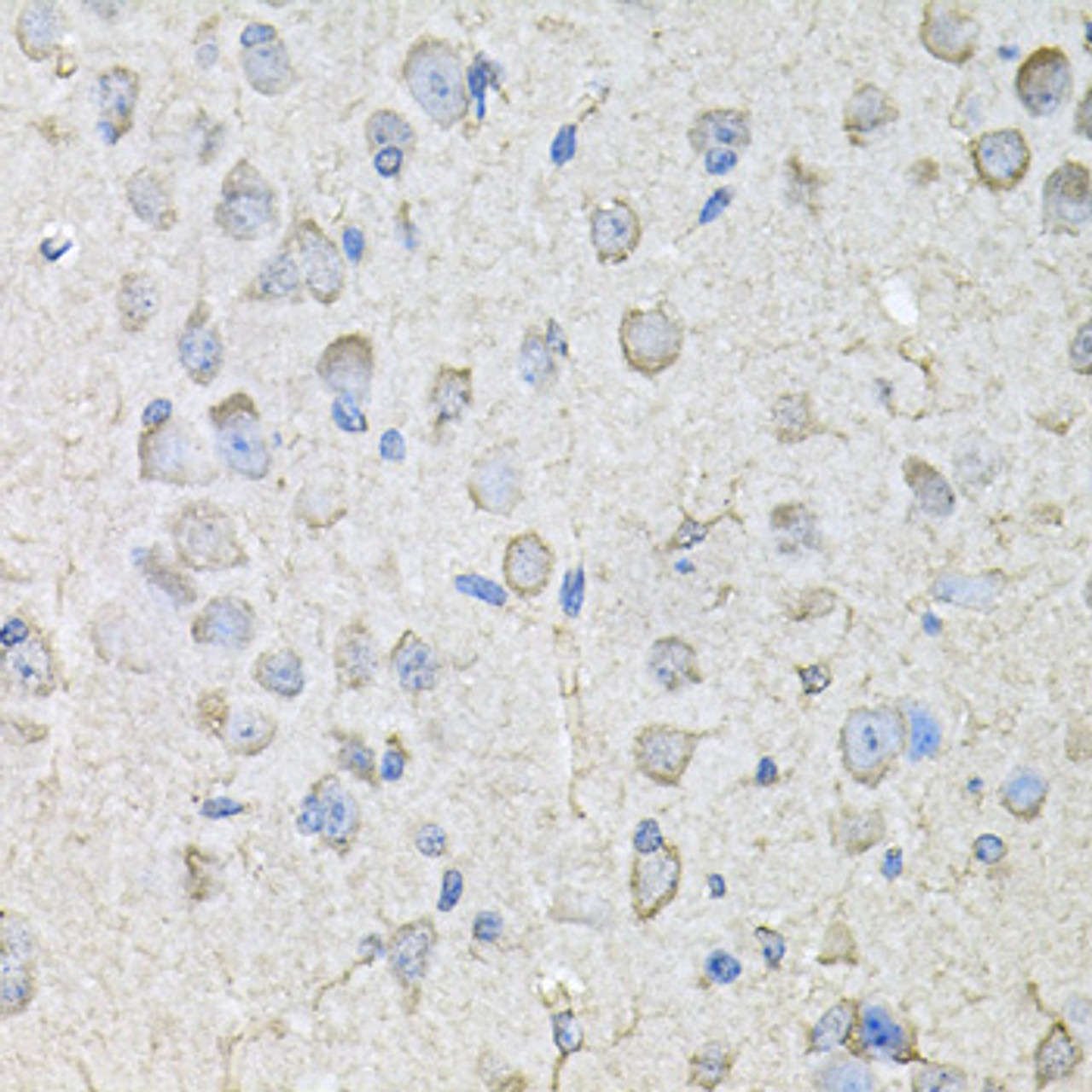 Immunohistochemistry of paraffin-embedded Mouse brain using CD97 Polyclonal Antibody at dilution of  1:100 (40x lens).