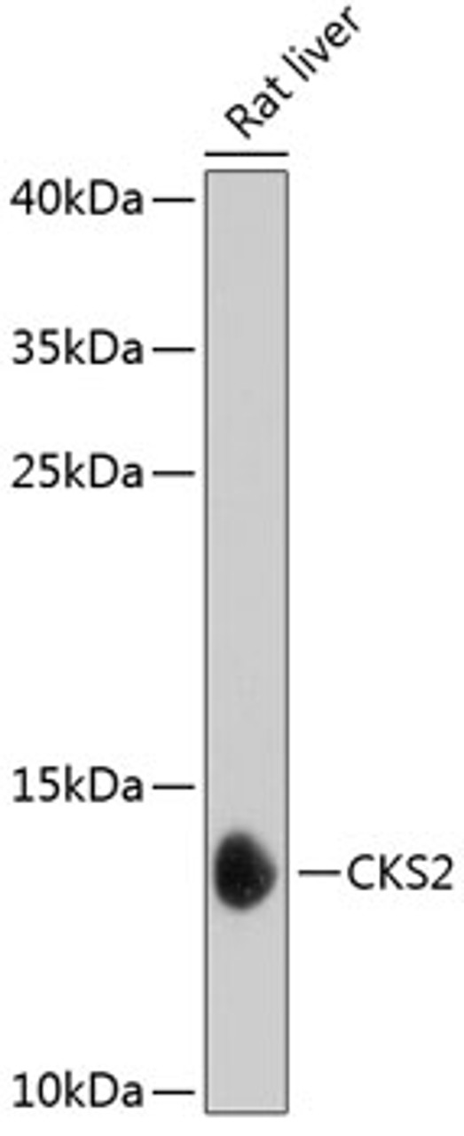 Western blot analysis of extracts of Rat liver using CKS2 Polyclonal Antibody at dilution of 1:1000.