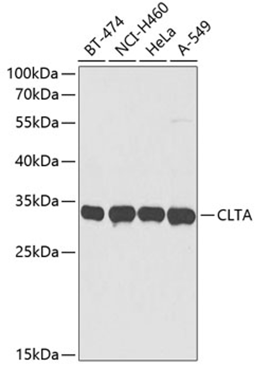 Western blot analysis of extracts of various cell lines using CLTA Polyclonal Antibody at dilution of 1:3000.