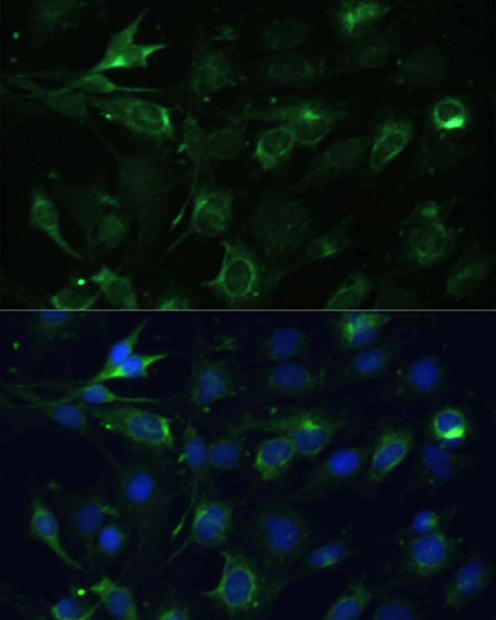 Immunofluorescence analysis of C6 cells using COX6A1 Polyclonal Antibody at dilution of  1:100 (40x lens). Blue: DAPI for nuclear staining.