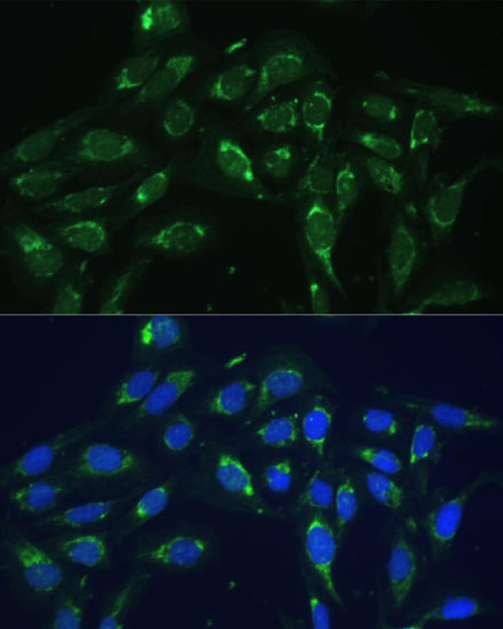 Immunofluorescence analysis of U-2 OS cells using COX6A1 Polyclonal Antibody at dilution of  1:100 (40x lens). Blue: DAPI for nuclear staining.