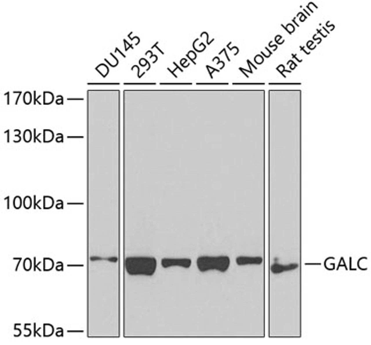 Western blot analysis of extracts of various cell lines using GALC Polyclonal Antibody at dilution of 1:1000.