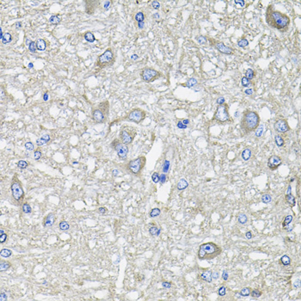 Immunohistochemistry of paraffin-embedded Rat brain using GFPT1 Polyclonal Antibody at dilution of  1:100 (40x lens).