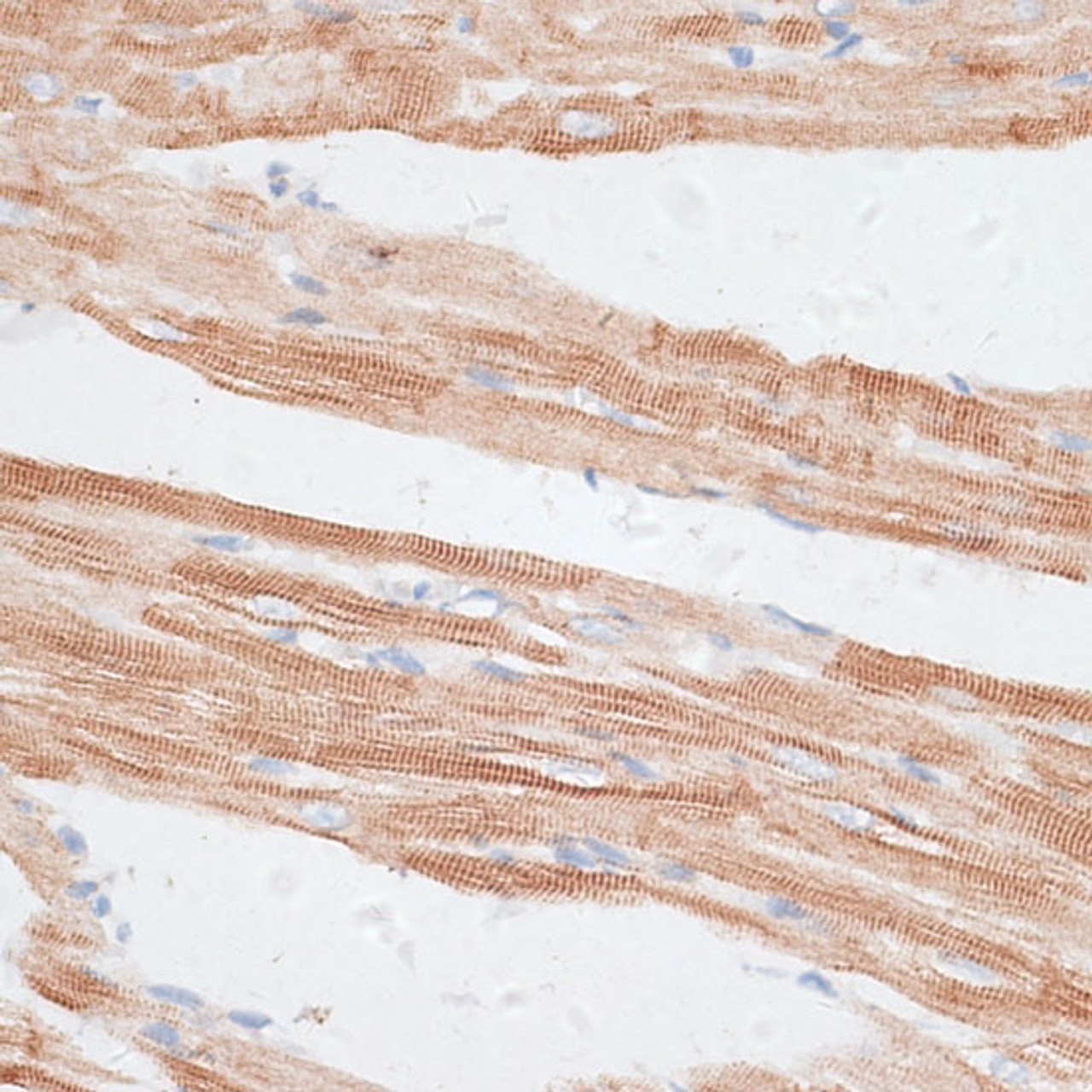 Immunohistochemistry of paraffin-embedded Rat heart using GRK5 Polyclonal Antibody at dilution of  1:100 (40x lens).