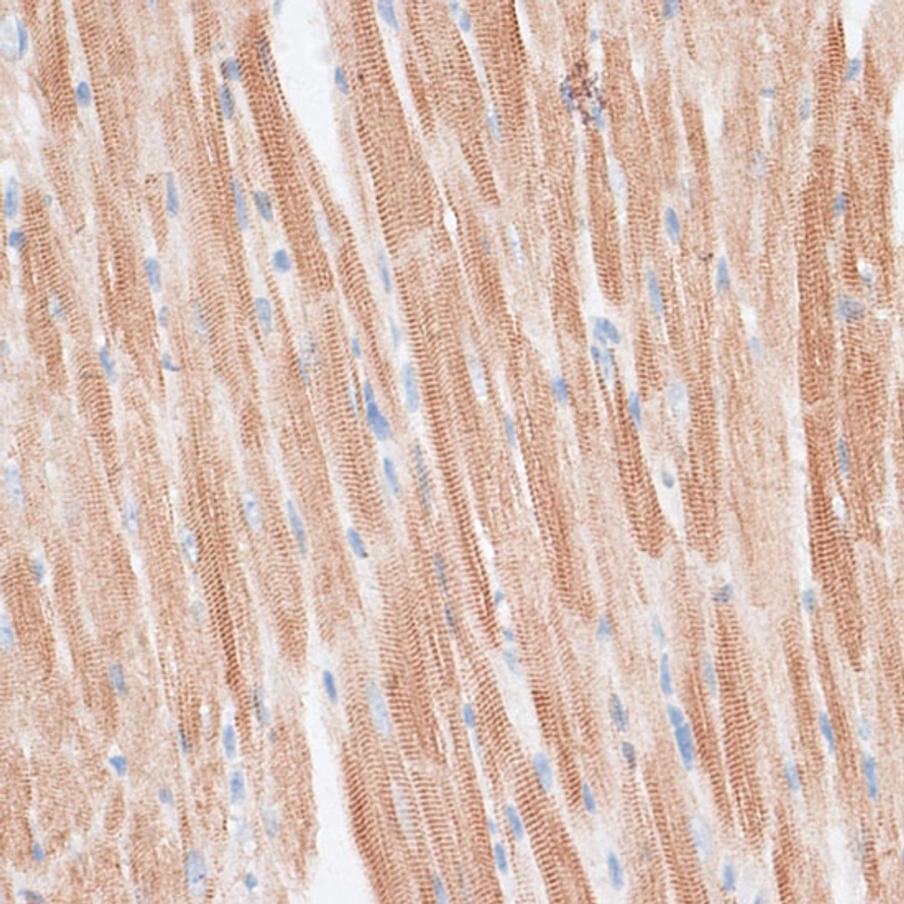 Immunohistochemistry of paraffin-embedded Mouse heart using GRK5 Polyclonal Antibody at dilution of  1:100 (40x lens).