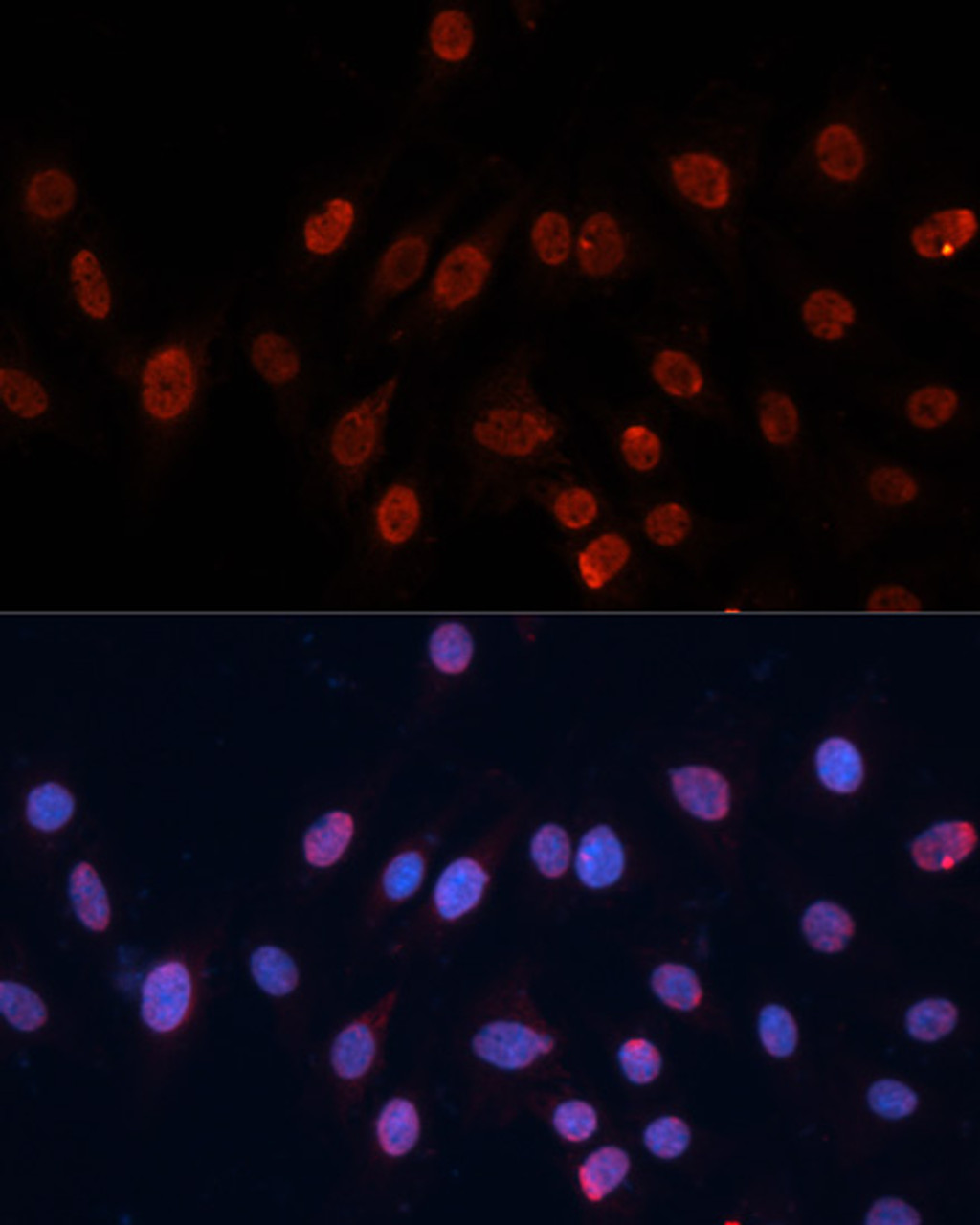 Immunofluorescence analysis of C6 cells using HNRNPU Polyclonal Antibody at dilution of  1:100. Blue: DAPI for nuclear staining.